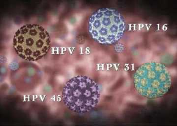 hpv疫苗一定能预防宫颈癌吗，哪些人群适合采用红卡治疗