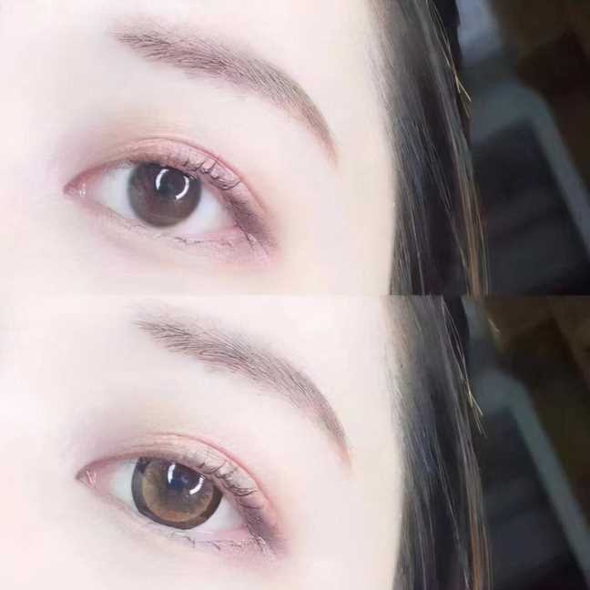 阚清子天生双色瞳孔，她的眼睛像宝石