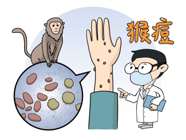 猴痘病毒是什么（猴痘病毒是单链还是双链）
