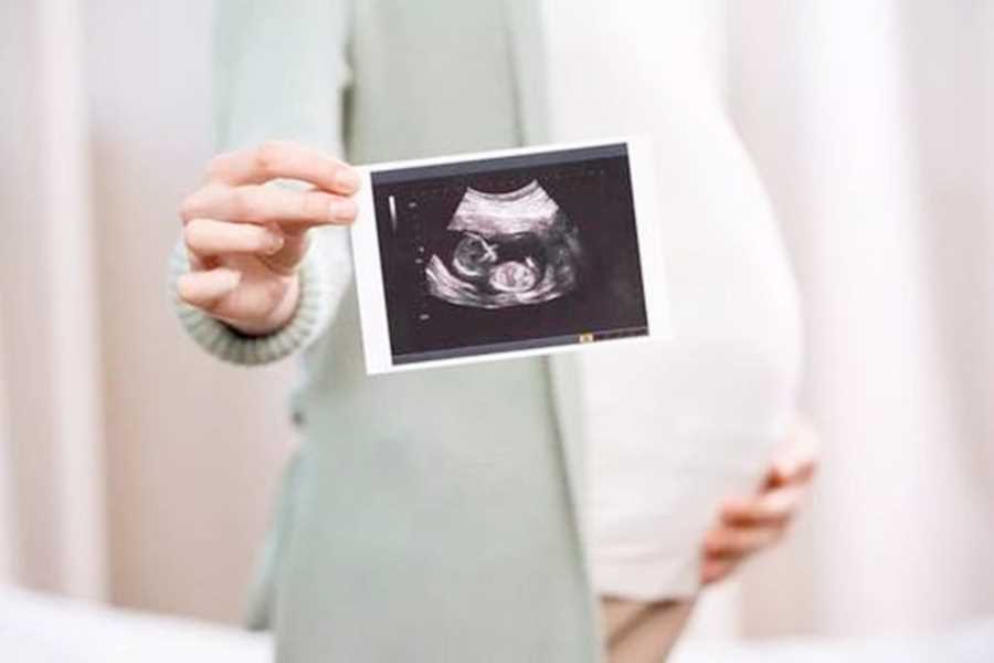 一张四维彩超检查单，轻松看出宝宝是男是女，孕妈先别高兴的太早