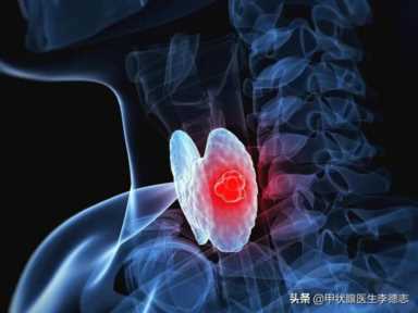 北京甲状腺排名第一名医院，甲状腺癌症北京哪个医院好(附2023年最新排行榜前十名单)